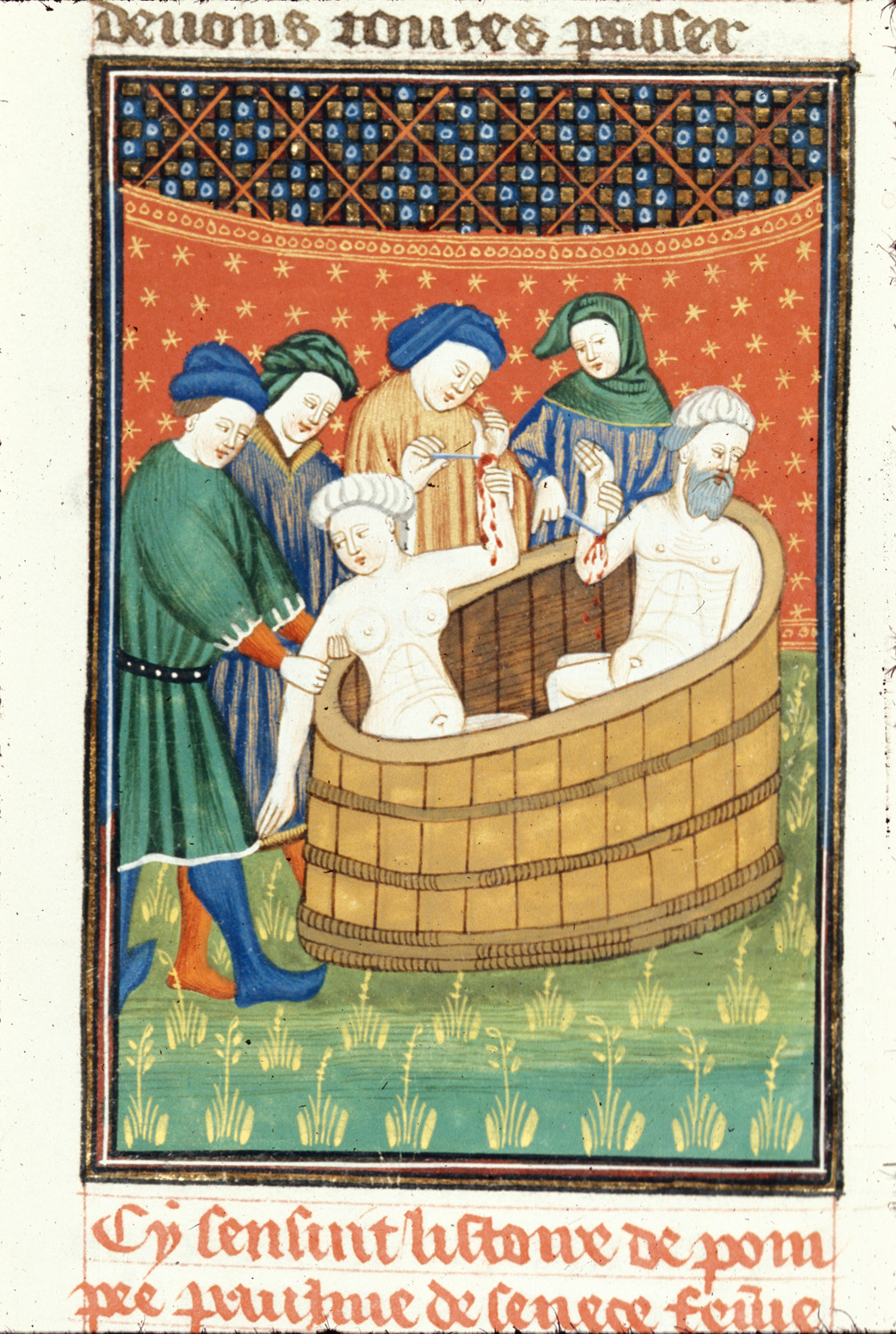 Seneca and his wife Pompeia Paulina being bled to death
